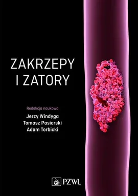 Zakrzepy i zatory - Tomasz Pasierski, Adam Torbicki, Jerzy Windyga