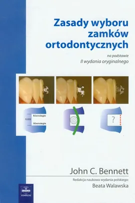 Zasady wyboru zamków ortodontycznych - Bennett John C.
