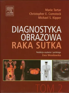 Diagnostyka obrazowa raka sutka Tom 2 - Comstock Christopher E., Kipper Michael S., Marie Tartar
