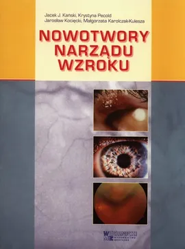 Nowotwory narządu wzroku - Kański Jacek J., Małgorzata Karolczak-Kulesza, Jarosław Kocięcki, Krystyna Pecold