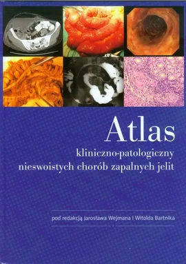 Atlas kliniczno-patologiczny nieswoistych chorób zapalnych jelit - Outlet